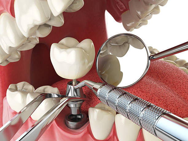 Best Emergency Cosmetic Dentistry (e.g., broken veneers) in Elyria, OH